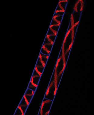 Spirogyra filaments showing normal cells on the left and elongated cells on the right.  The cell outline is blue, and within each cell, the spiraling chloroplast is red. Photo: Bram Van de Poel (Click image to download hi-res version.)