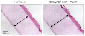 These cross-section images show three-dimensional human skin models made of living skin cells. Untreated model skin (left panel) shows a thinner dermis layer (black arrow) compared with model skin treated with the antioxidant methylene blue (right panel). A new study suggests that methylene blue could slow or reverse dermal thinning (a sign of aging) and a number of other symptoms of aging in human skin. Image credit: Zheng-Mei Xiong/University of Maryland (Click image to download hi-res version.)