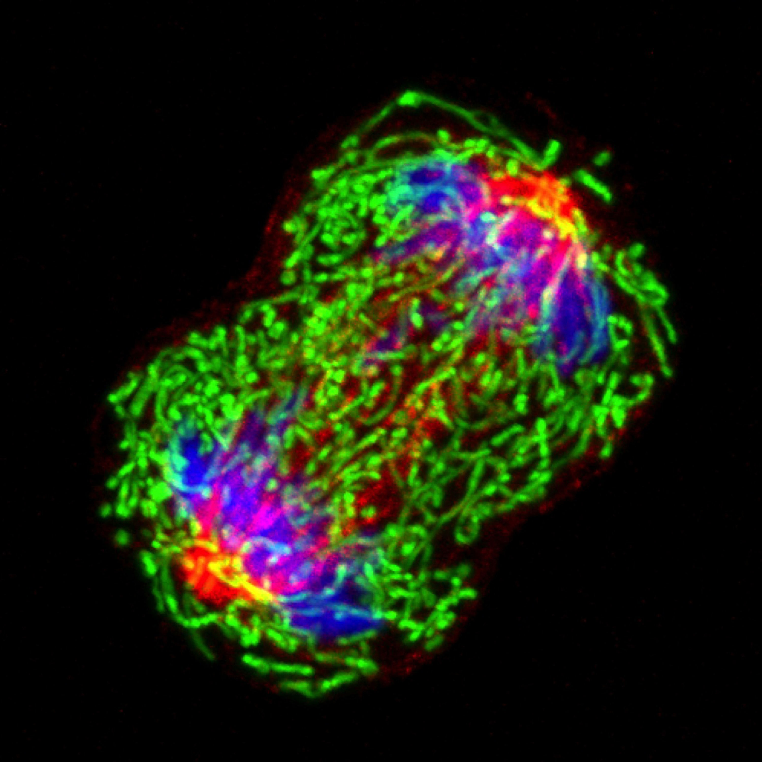 New research shows that the interactions between genes expressed at different levels can impact cell survival. Studying those interactions can help researchers understand why individuals respond differently to treatment and identify subtypes of certain cancers such as this triple-negative (MDA-MB-231) breast cancer cell seen here during cell division. Photo credit: NCI_University of Pittsburgh Cancer Institute. (Click on image for hi res version.)