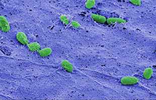 In this false-colored image, individual cells of Pseudomonas aeruginosa (green) can be seen resting on the fibrous surface of a biofilm (purple) that helps protect cells beneath its surface. At top right, two cells incorporated within the biofilm peek out from a fissure in the film's surface. Image credit: Debra Weinstein, Sao-Mai Nguyen-Mau, and Vincent Lee (Click image to download hi-res version.)