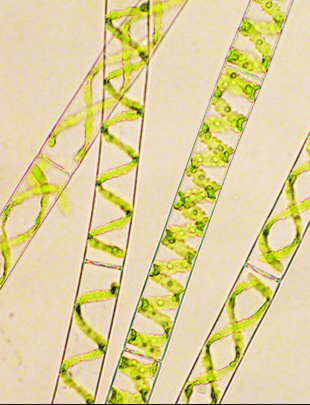 Microscopic images of Spirogyra pratensis filaments showing the spiraling green chloroplasts for which Spirogyra is named. Photo: Bram Van de Poel (Click image to download hi-res version.)
