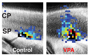 These images of mouse brains compare laser scanning photostimulation maps of all the neurons connected to one central neuron in control mice (left) vs. mice dosed with valproic acid (VPA) to induce autism-like symptoms (right). The researchers focused on neurons in the subplate (SP) region, directly below the developing cortex (CP, or cortical plate), which controls perception and behavior. The central neuron is marked in white, and each colored square represents a neuron that has a direct synaptic connection to the central neuron. Reds and oranges represent stronger connections compared with greens and blues, indicating that subplate neurons in VPA-treated mice form numerous strong connections early in development. Image Credit: Daniel Nagode/Patrick Kanold (Click image to download hi-res version.)
