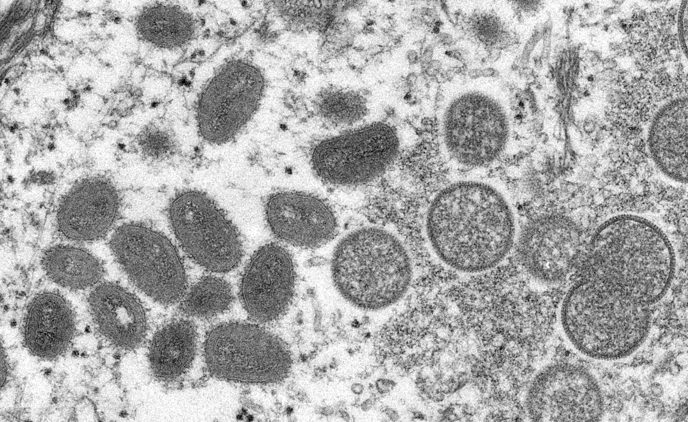 This electron microscopic image depicts monkeypox virus particles obtained from a sample associated with the 2003 prairie dog outbreak. On the left are mature, oval-shaped particles. On the right are crescents and spherical particles of immature virions.  Courtesy of CDC/Cynthia Goldsmith.