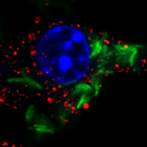 The image shows an infected cell with staining for Mycobacterium tuberculosis (green), the cell nucleus (blue) and a host protein involved in detection of intracellular pathogens (red). (Image Credit: Shivangi Rastogi