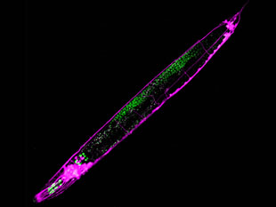 UMD scientists have discovered a mechanism for transgenerational gene silencing in the roundworm Caenorhabditis elegans. Special fluorescent dyes help to visualize neurons (magenta) and germ cells (green) in the roundworm's body. Photo: Sindhuja Devanapally (Click image to download hi-res version.)