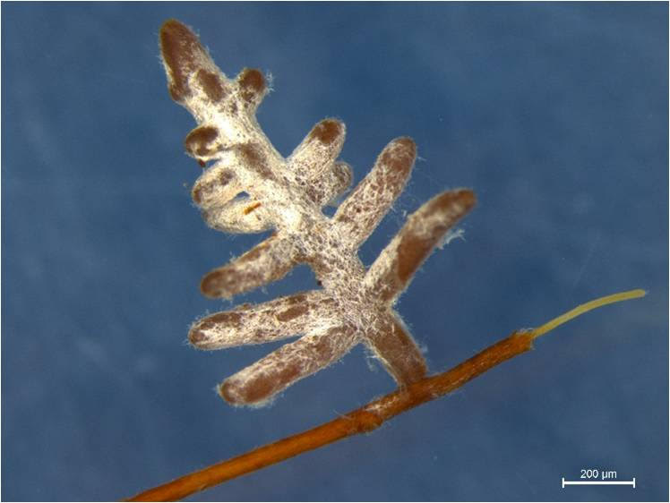 Trees derive nutrients from beneficial fungi on their roots. A new study shows that ectomycorrhizal fungi, such as this white fuzzy-looking fungi coating the root in the image above, may protect trees from pathogens compared with arbuscular mycorrhizal fungi, which bores into roots and may provide a pathway for harmful fungi. Photo credit: Yonglong Wang/Institute of Botany, Chinese Academy of Sciences (Click image to download hi-res version.)